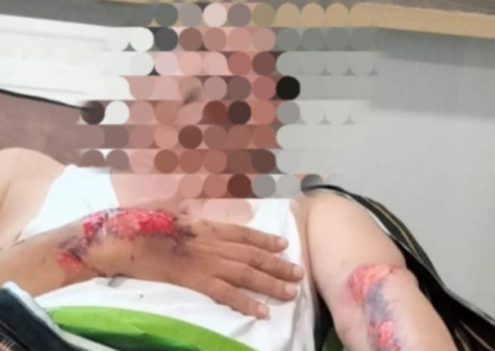 IMG-20241108-WA0004 Wakil Ketua LSM GMBI Karawang Minta PLN Bisa Maksimal Bertanggung Jawab Adanya Kades Yang Terjerat Kabel PLN