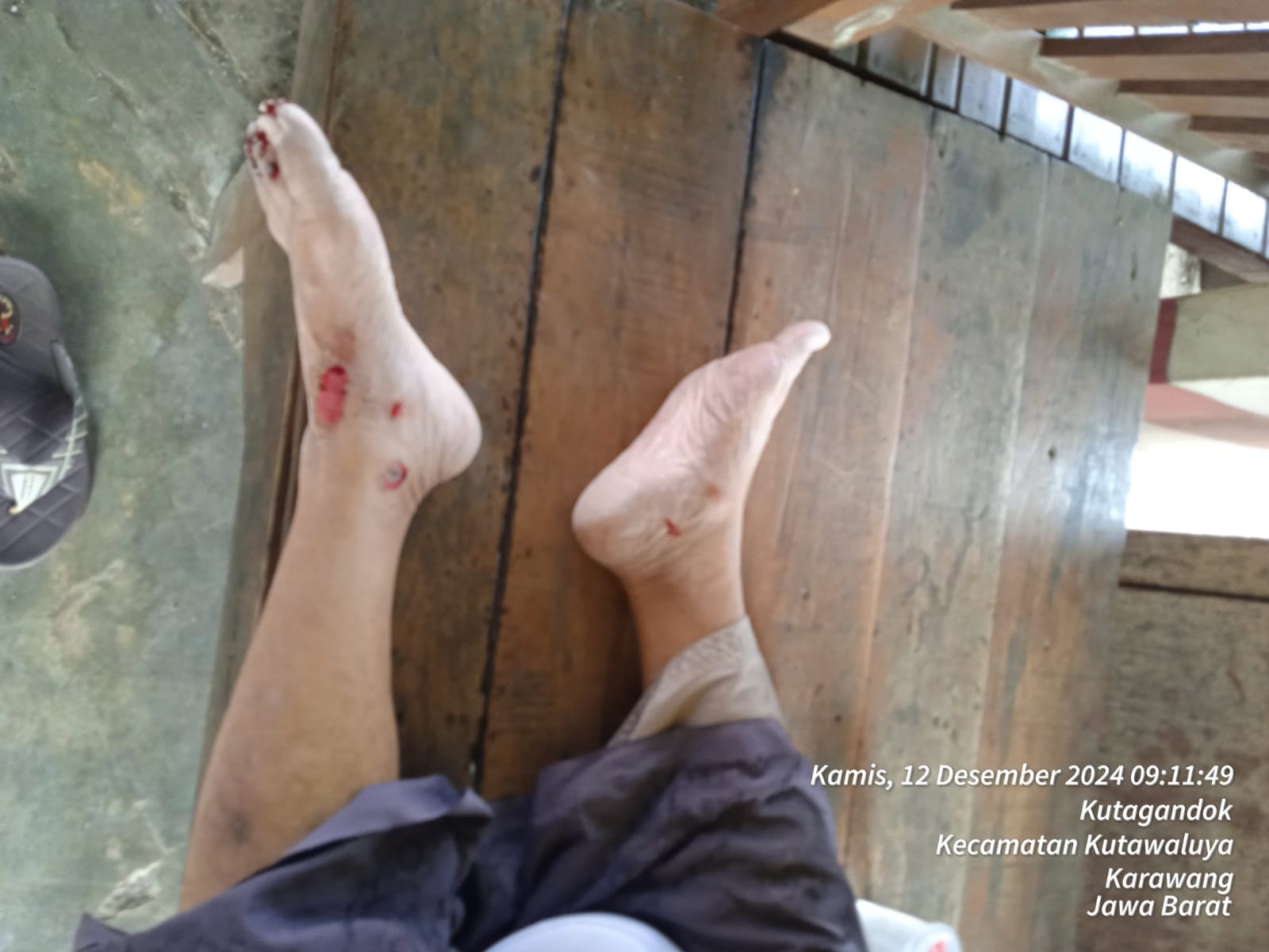 IMG-20241212-WA0006 Jalan Rusak Dan Berlubang Mengakibatkan Kecelakaan. Warga Setempat Minta Perbaikan Secepatnya